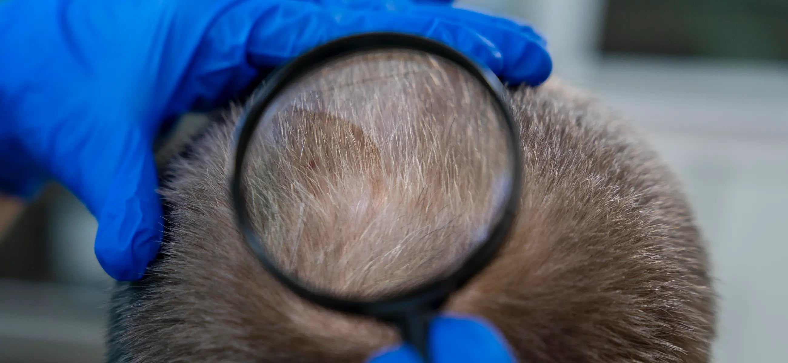 Alopecia areata: Causes, symptoms, and therapies