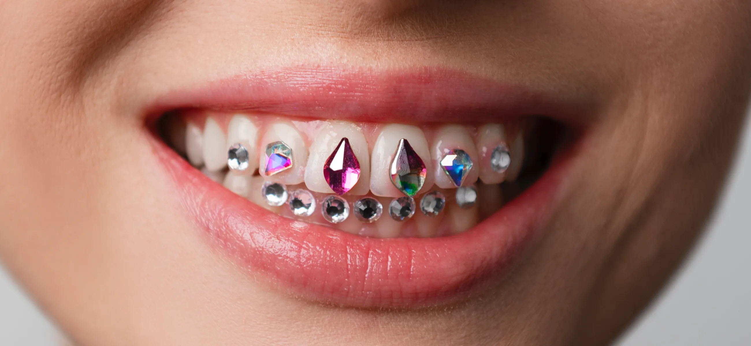 Worth the bling? Everything you need to know about dental grills