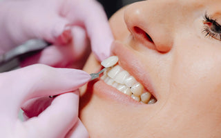 Cosmetic dentistry 101 - How to elevate your smile with dental veneers