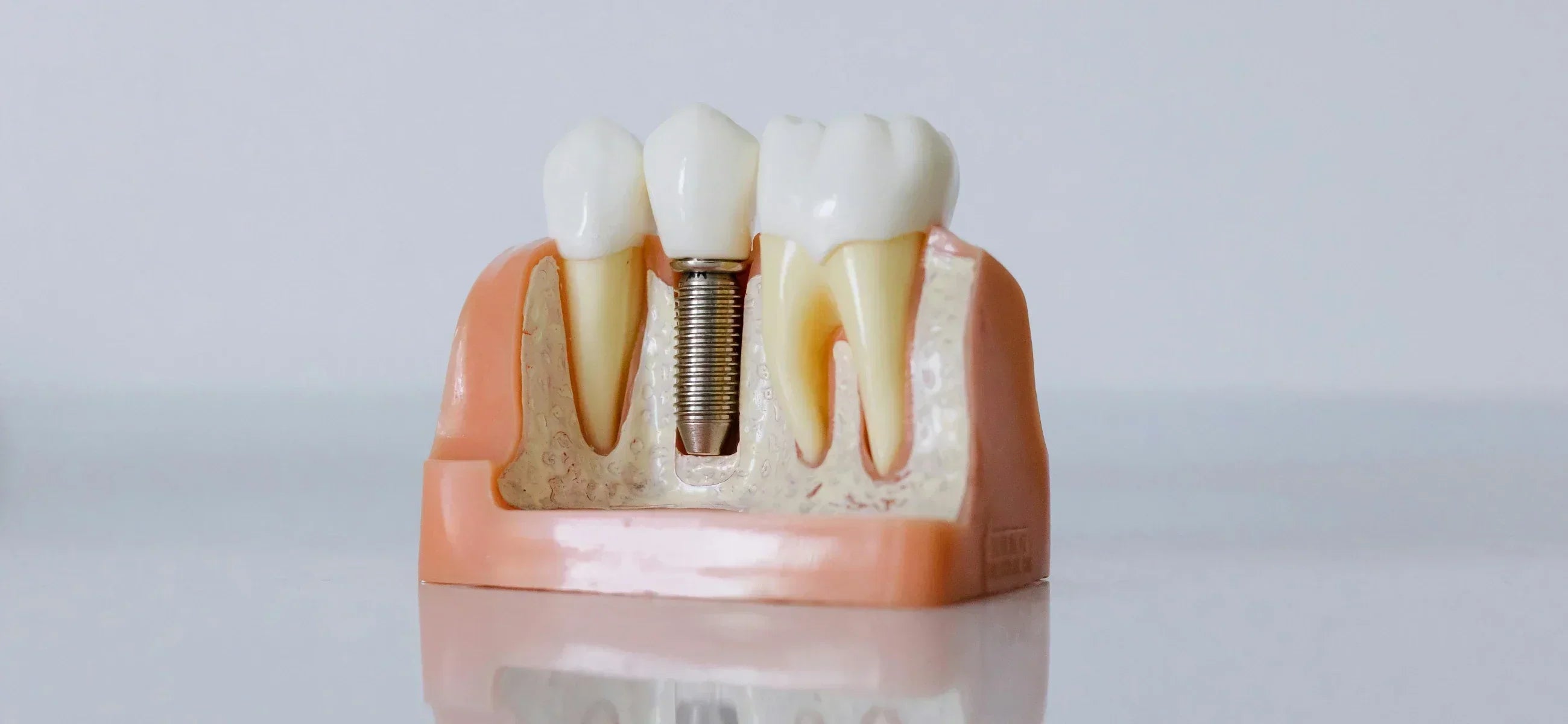 How to deal with exposed bone after tooth extraction
