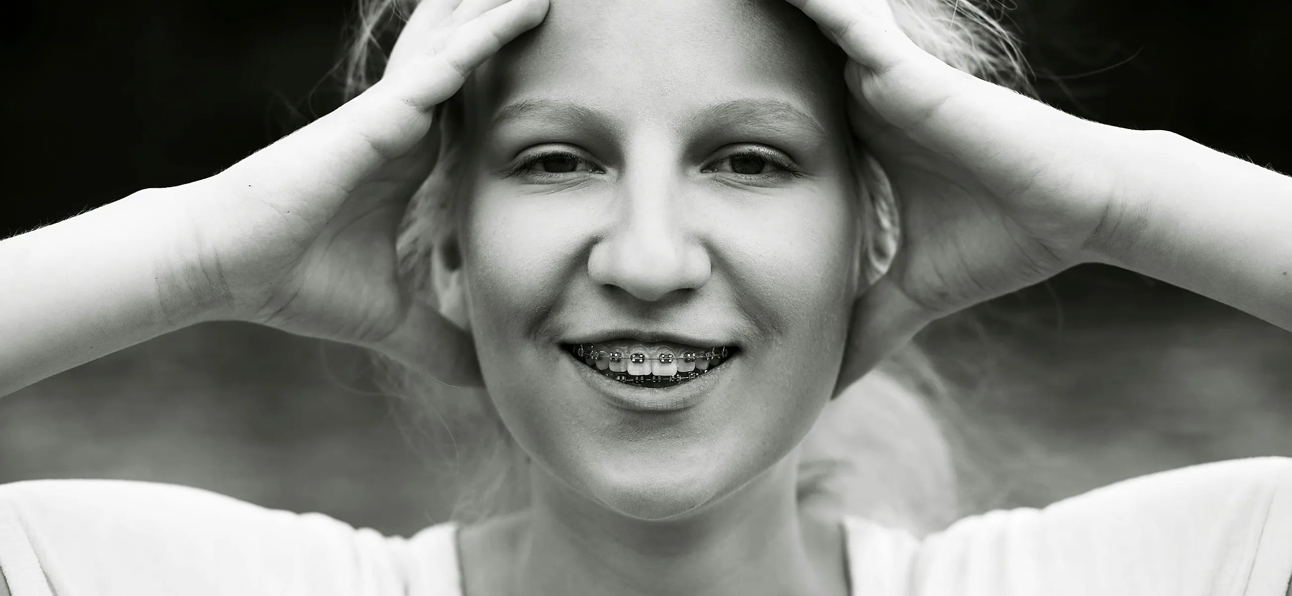 Maintenance, diet, and aftercare: How to take care of braces at home
