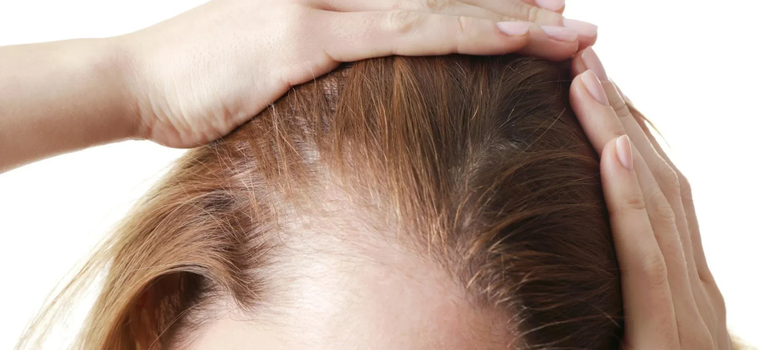 Understanding normal hair loss: What’s typical vs. What’s not