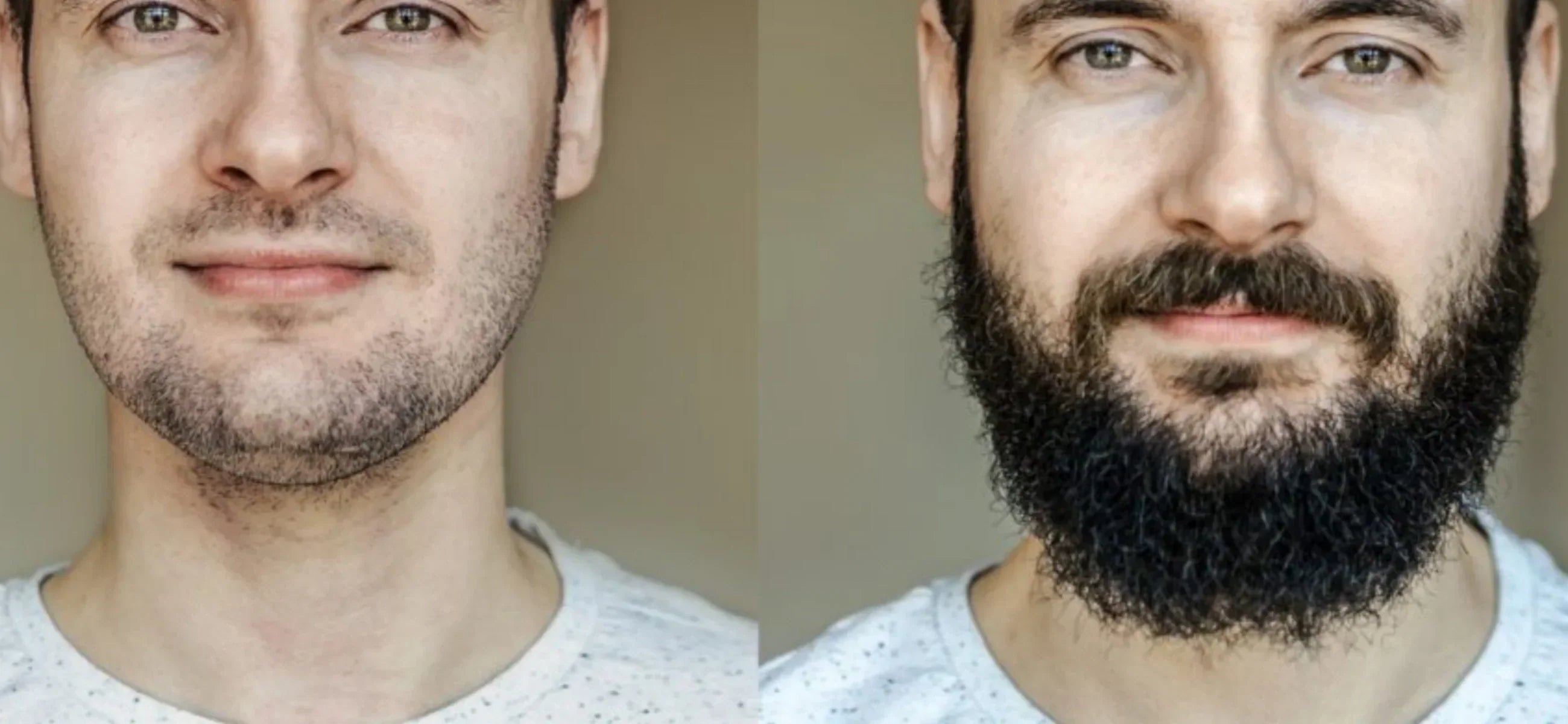 Want a fuller beard? Try these 5 growth-boosting m3ethods
