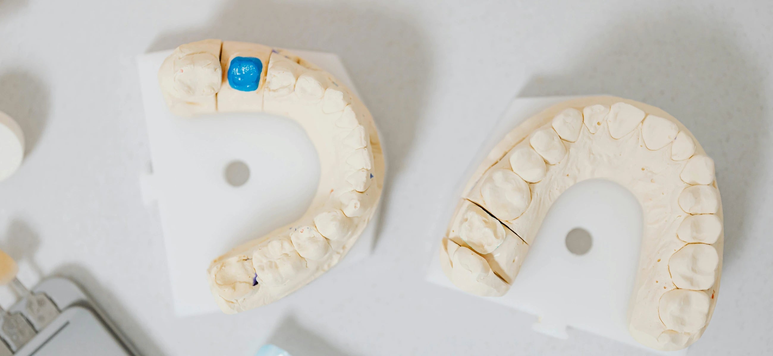 Acid attack - how enamel erosion can damage your teeth