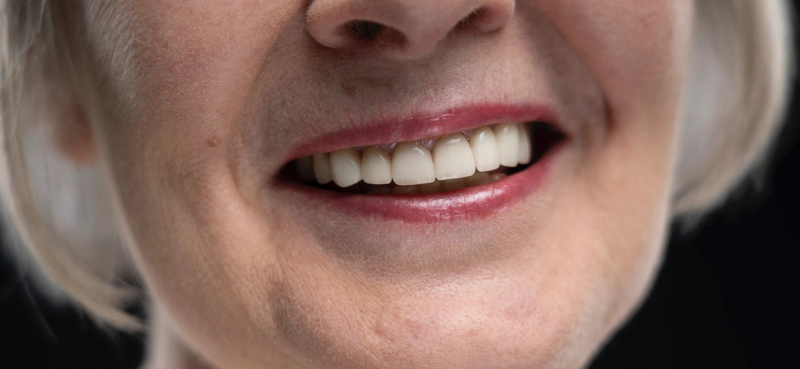 Bone loss in teeth and gums: Symptoms, reasons, and how to treat