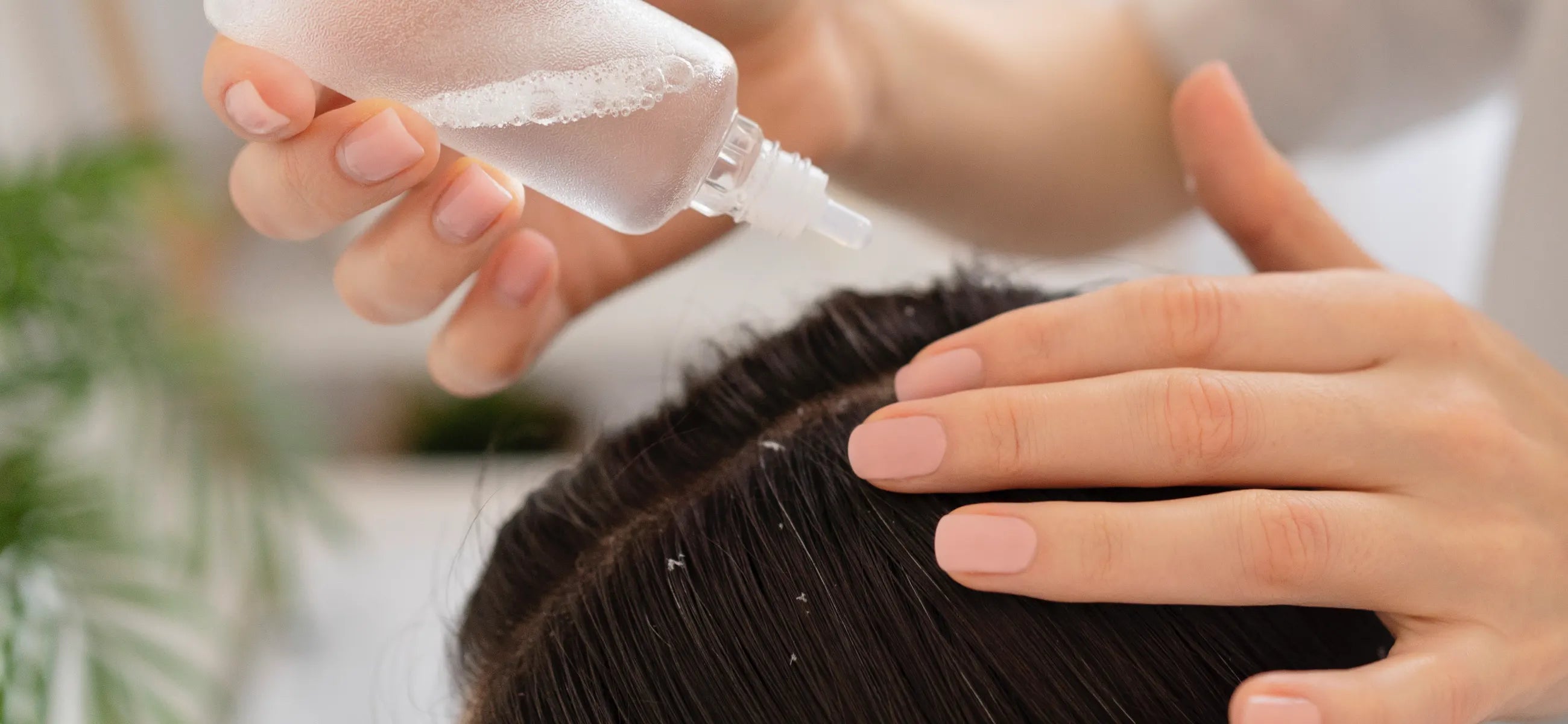 What is the right Dandruff treatment for me?