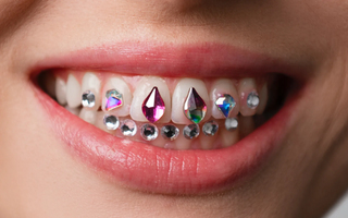 Worth the bling? Everything you need to know about dental grills