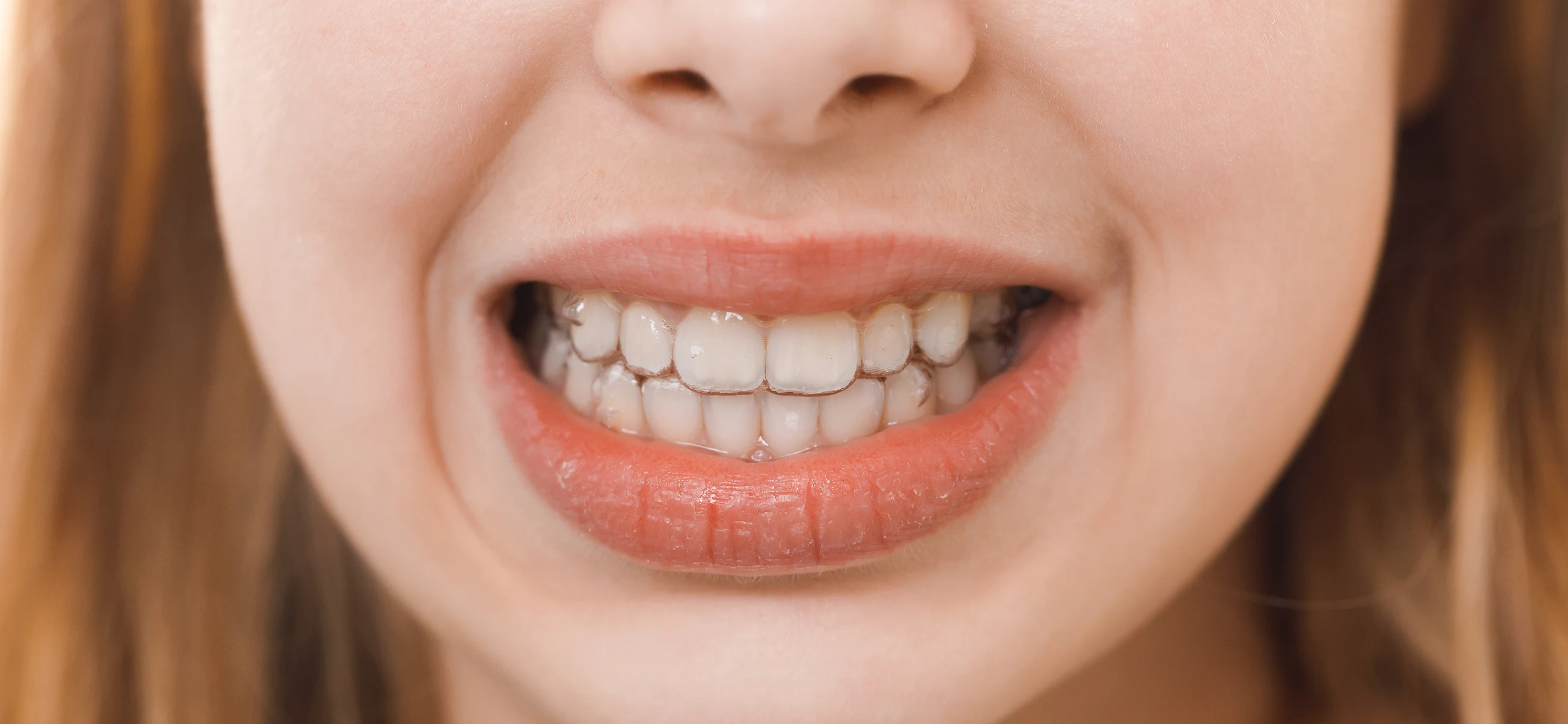 5 symptoms of fluoride deficiency & how to treat it