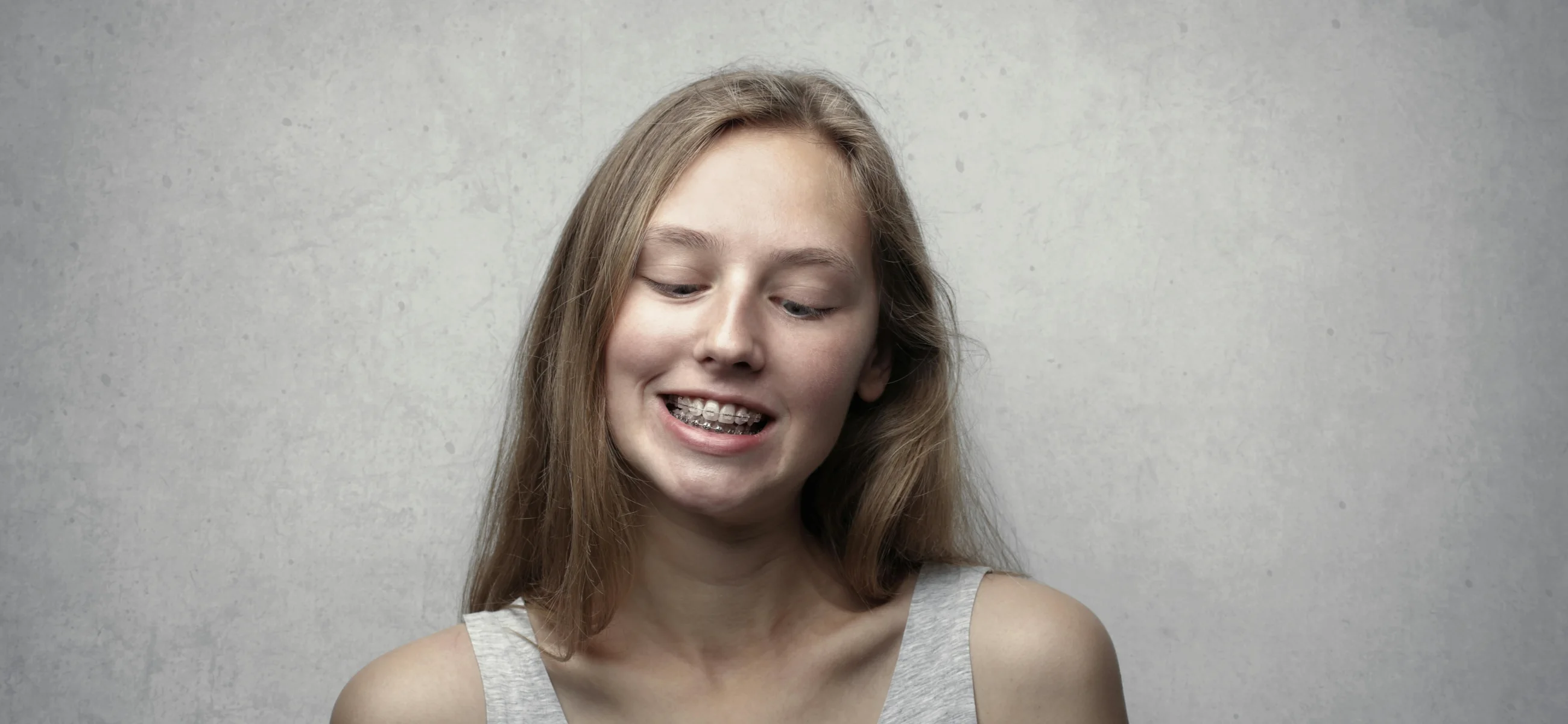 Everything about getting braces as an adult: Is it good?