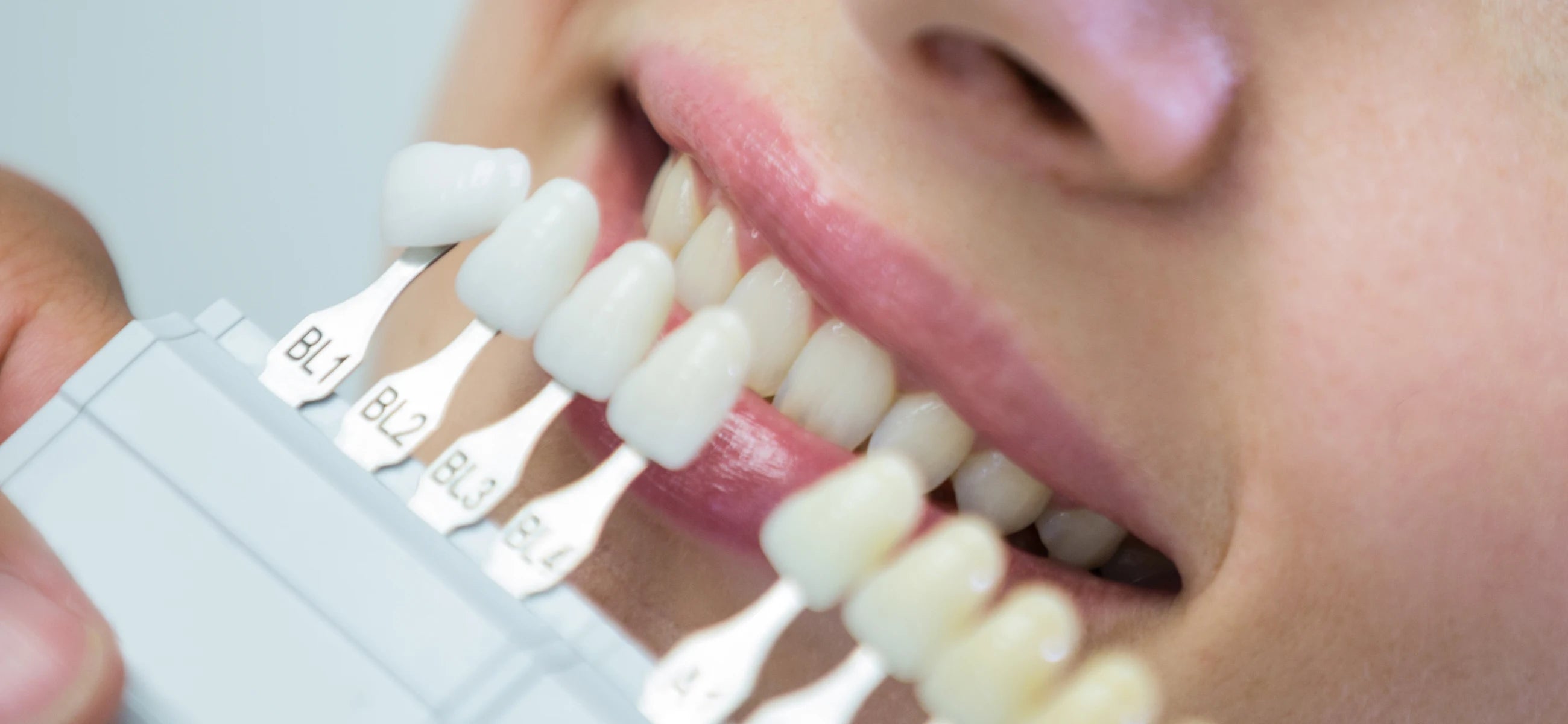 Beyond the brush: Instant teeth whitening at home