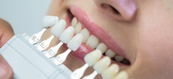 Beyond the brush: Instant teeth whitening at home 