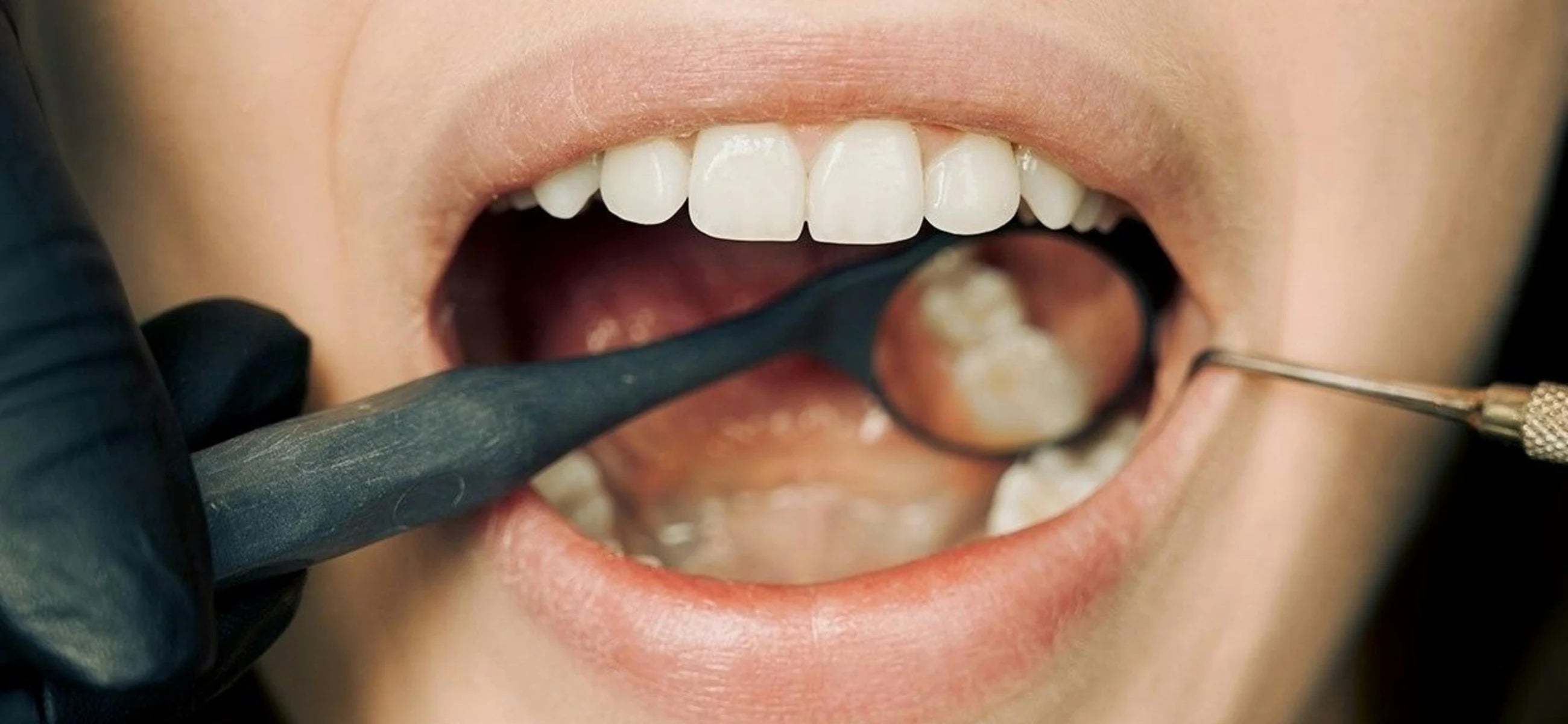 How to have good oral hygiene