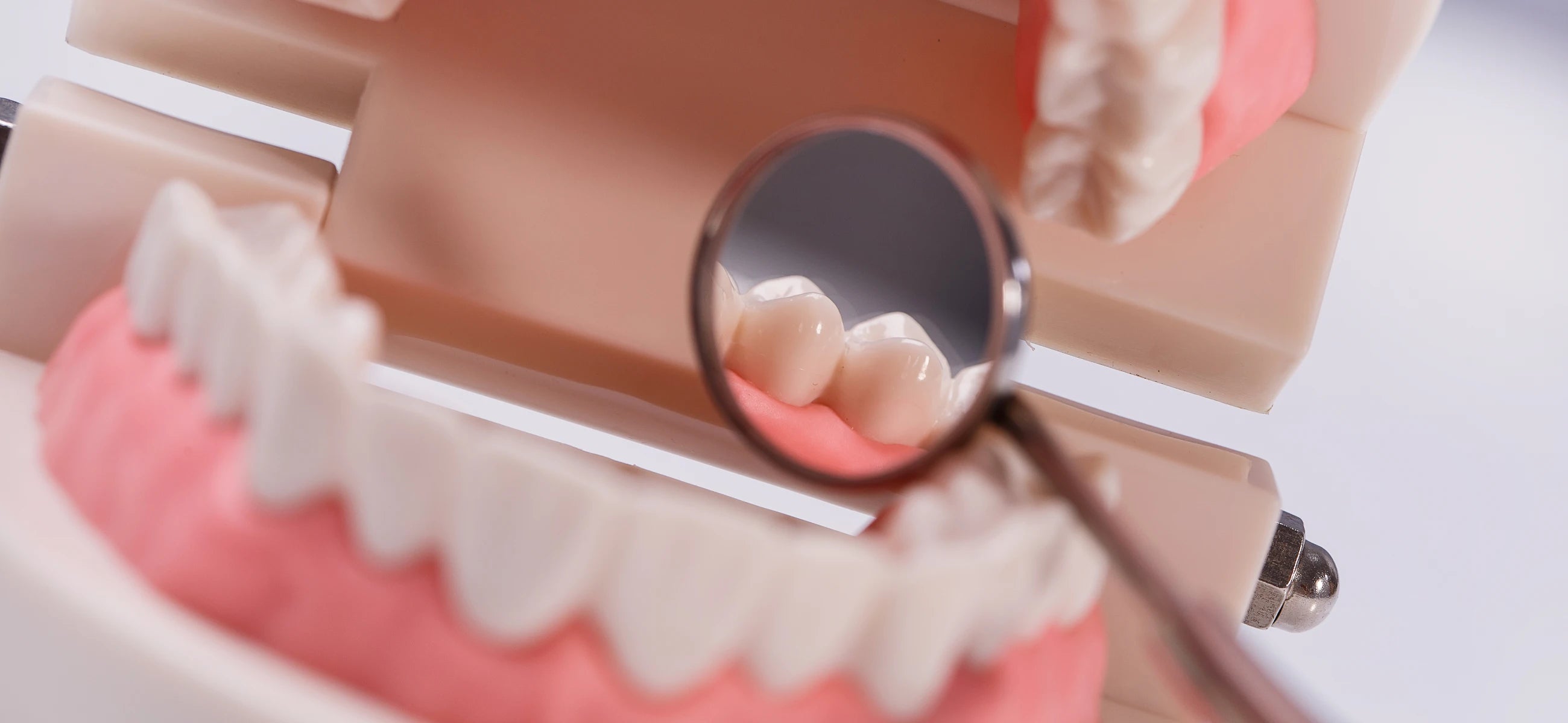 Endodontics explained: What is a root canal?