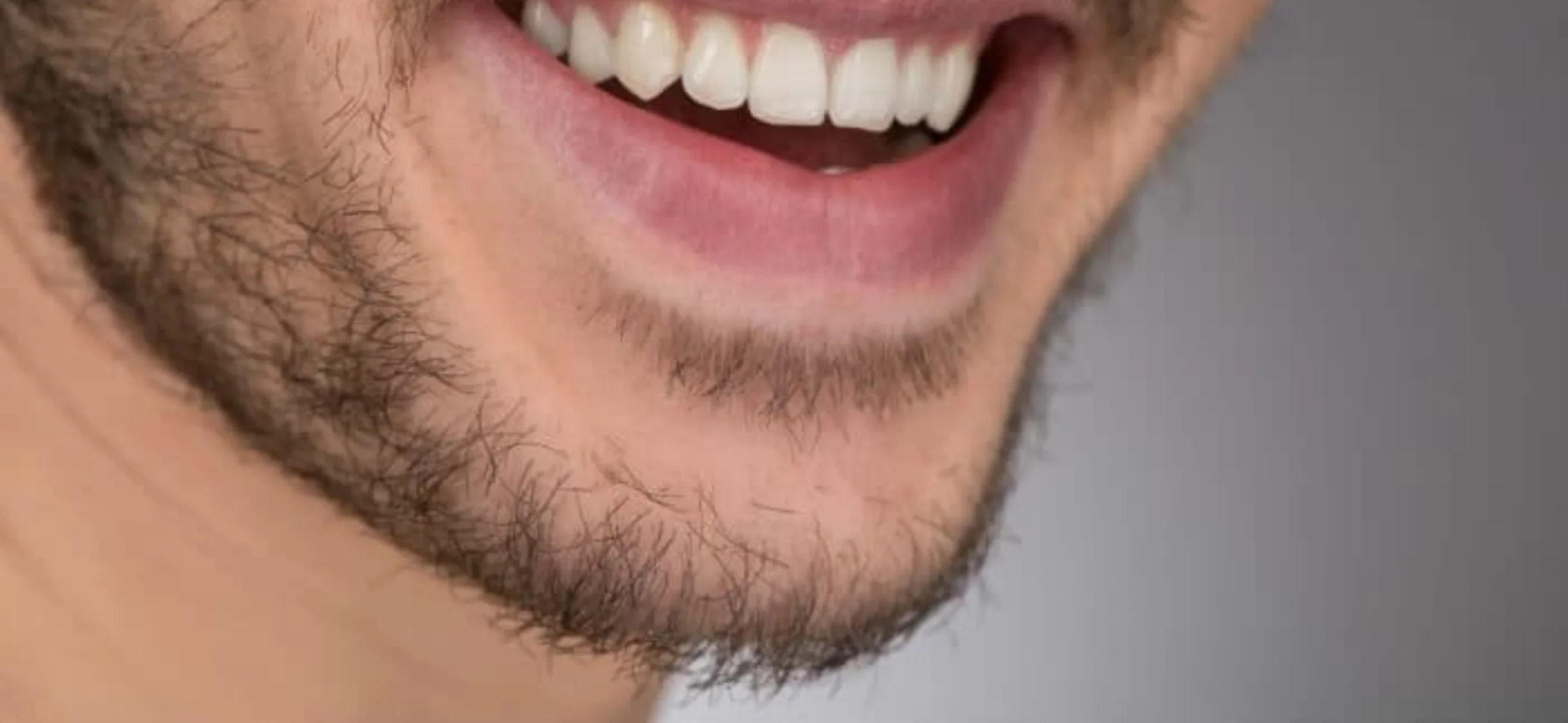 Beard feels uncomfortable? Shave it or fix it