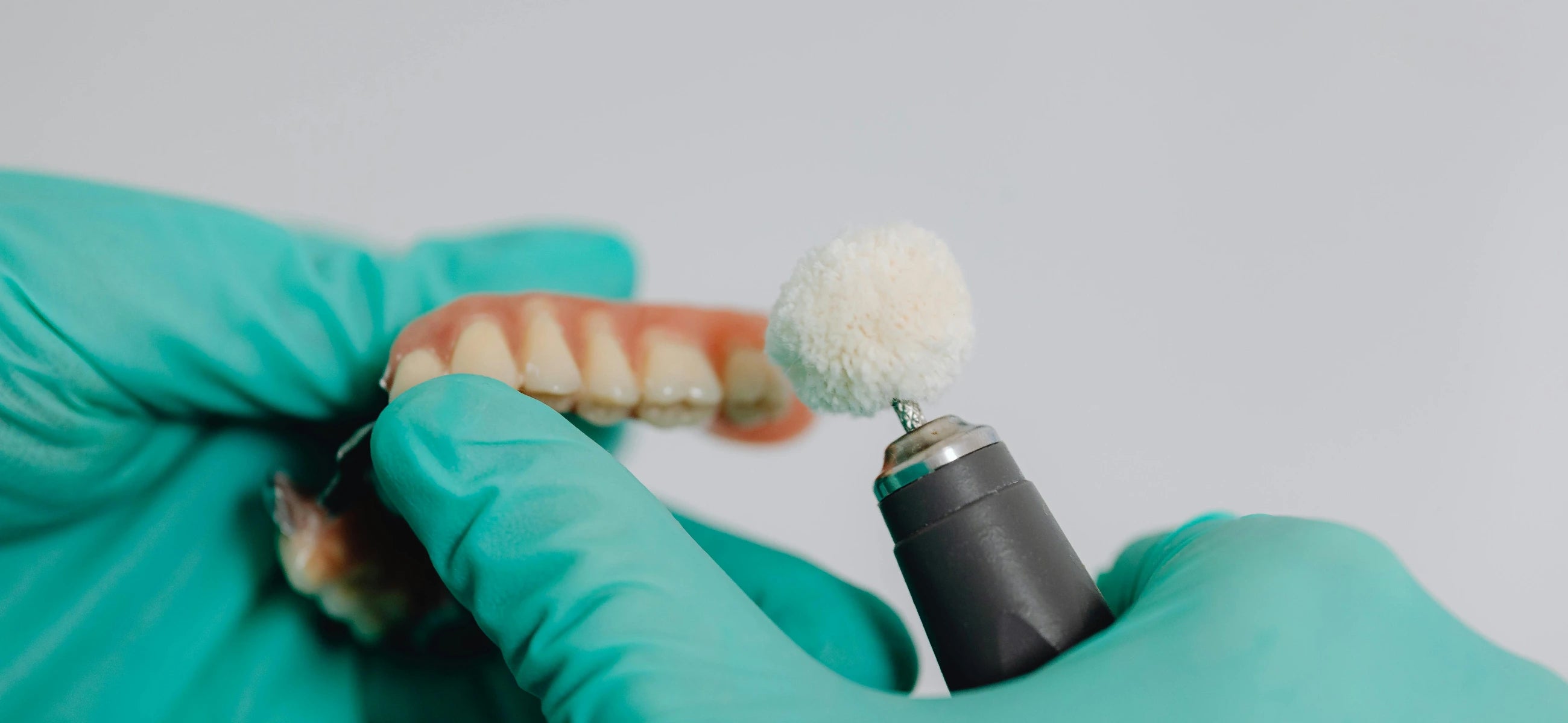 What is a dry socket after a tooth extraction?