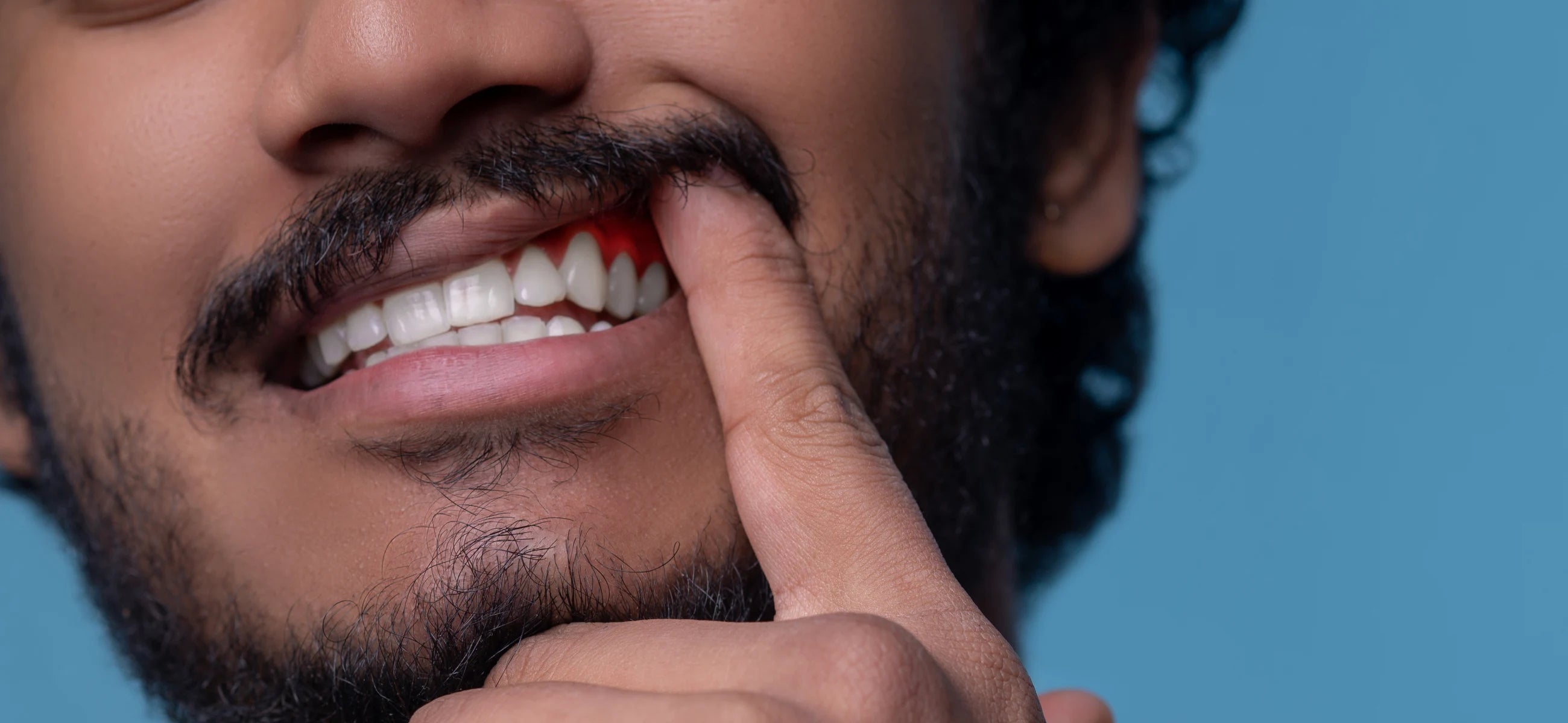Beyond the brush - The threat of gingivitis to your dental health