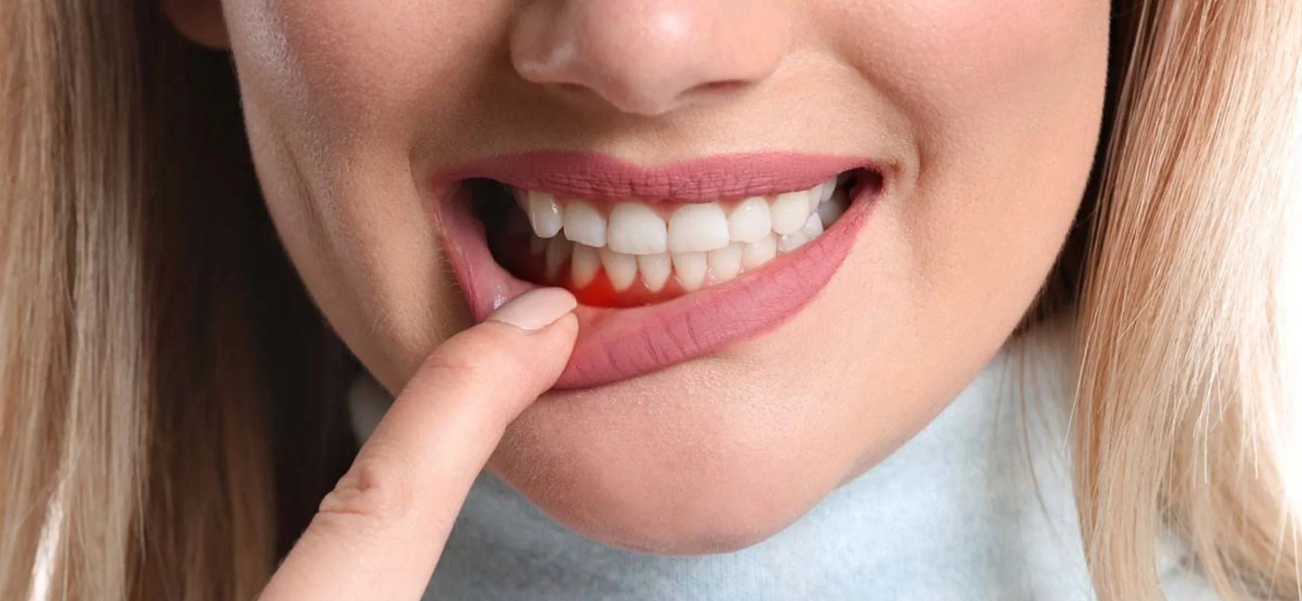 What is the fastest way to cure gingivitis?