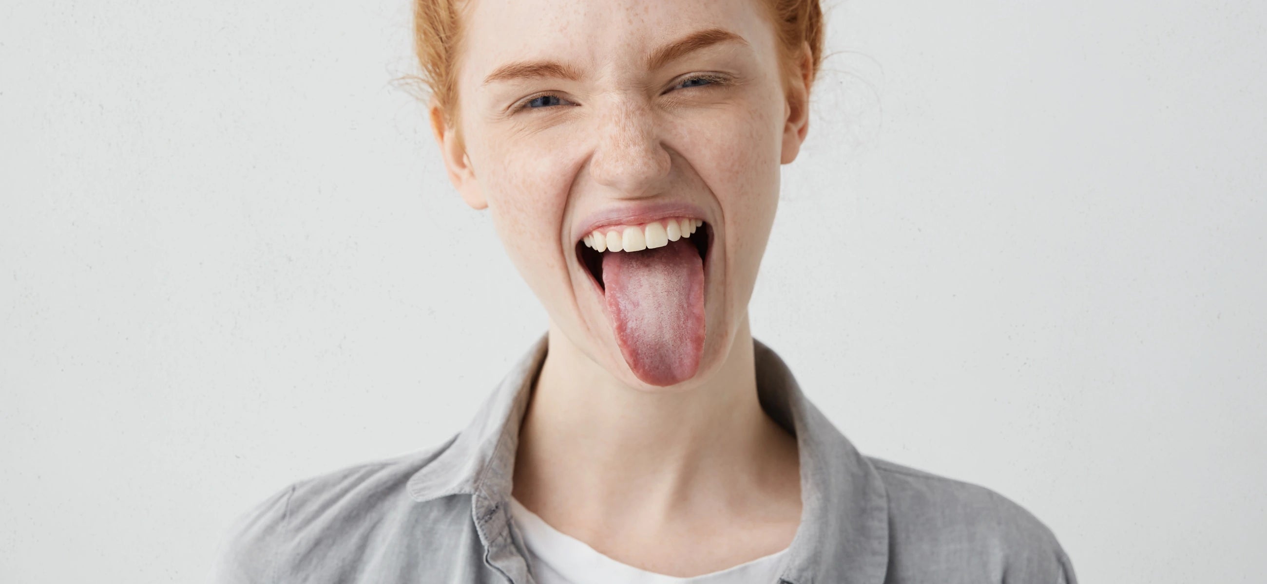 What is white tongue? Definition, causes, and treatment