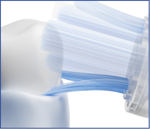 Close-up of a dental model with a toothbrush on top