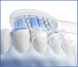 Diagram of dental crowns being fitted onto teeth